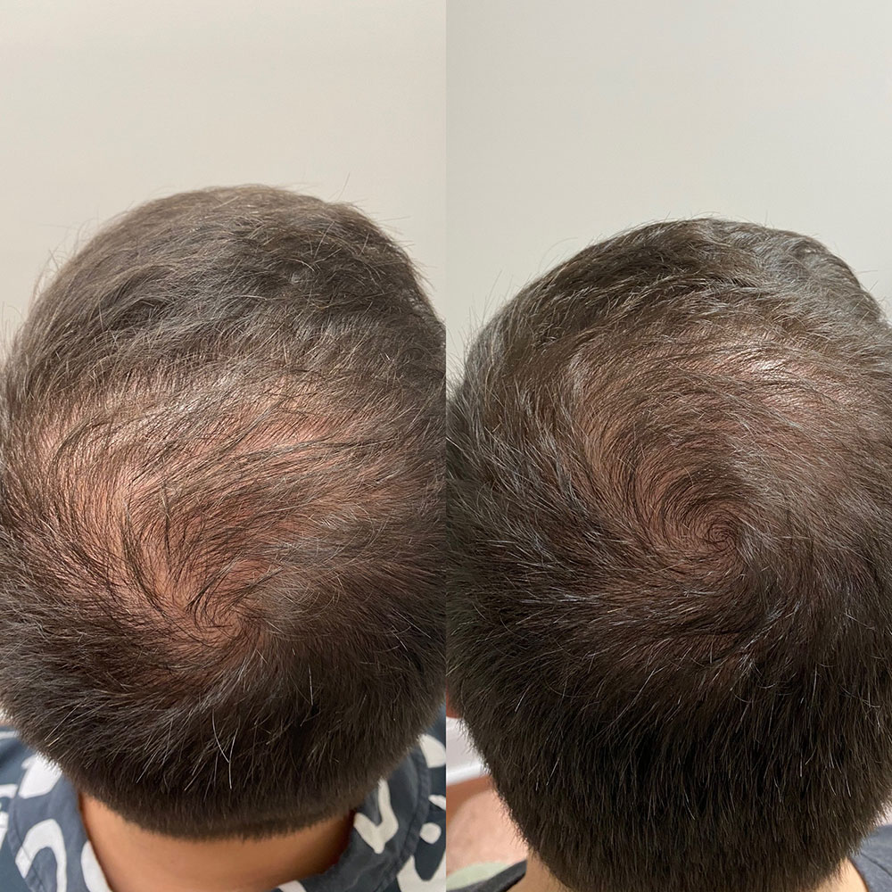 b & a hair restoration