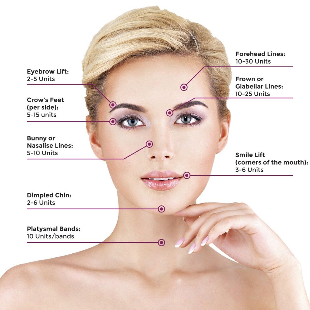 BOTOX® guide