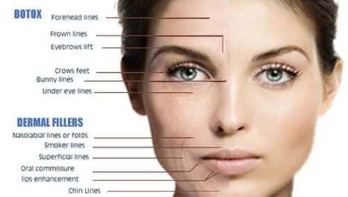 injectables BOTOX® fillers