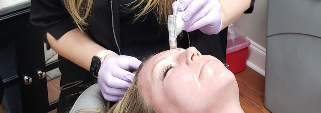 services microneedling