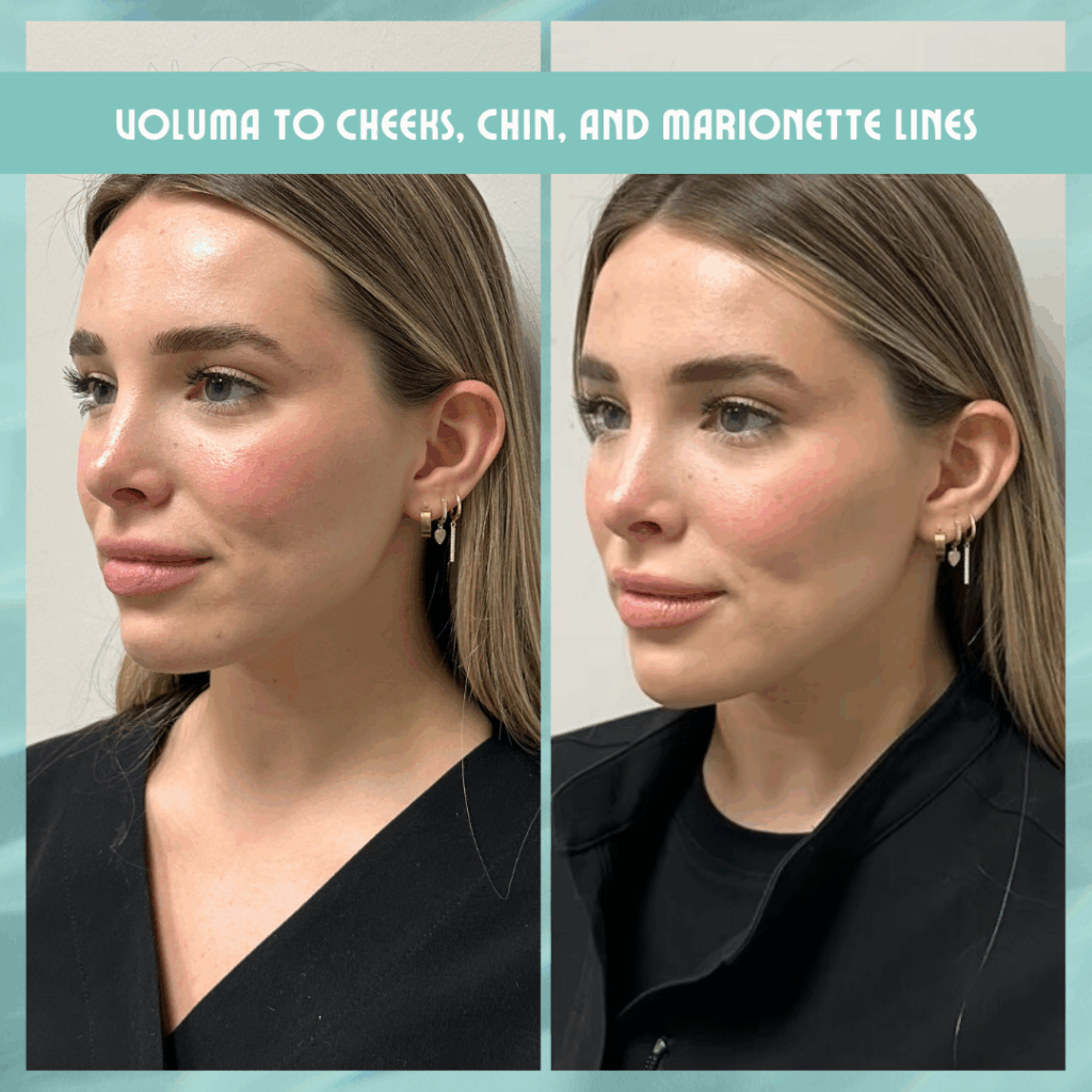before & after