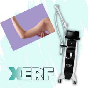 xerf arms germantown only