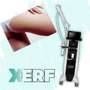 xerf back of thighs