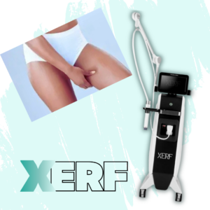 xerf front of thighs germantown only